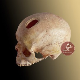Cráneo trepanado neolítico